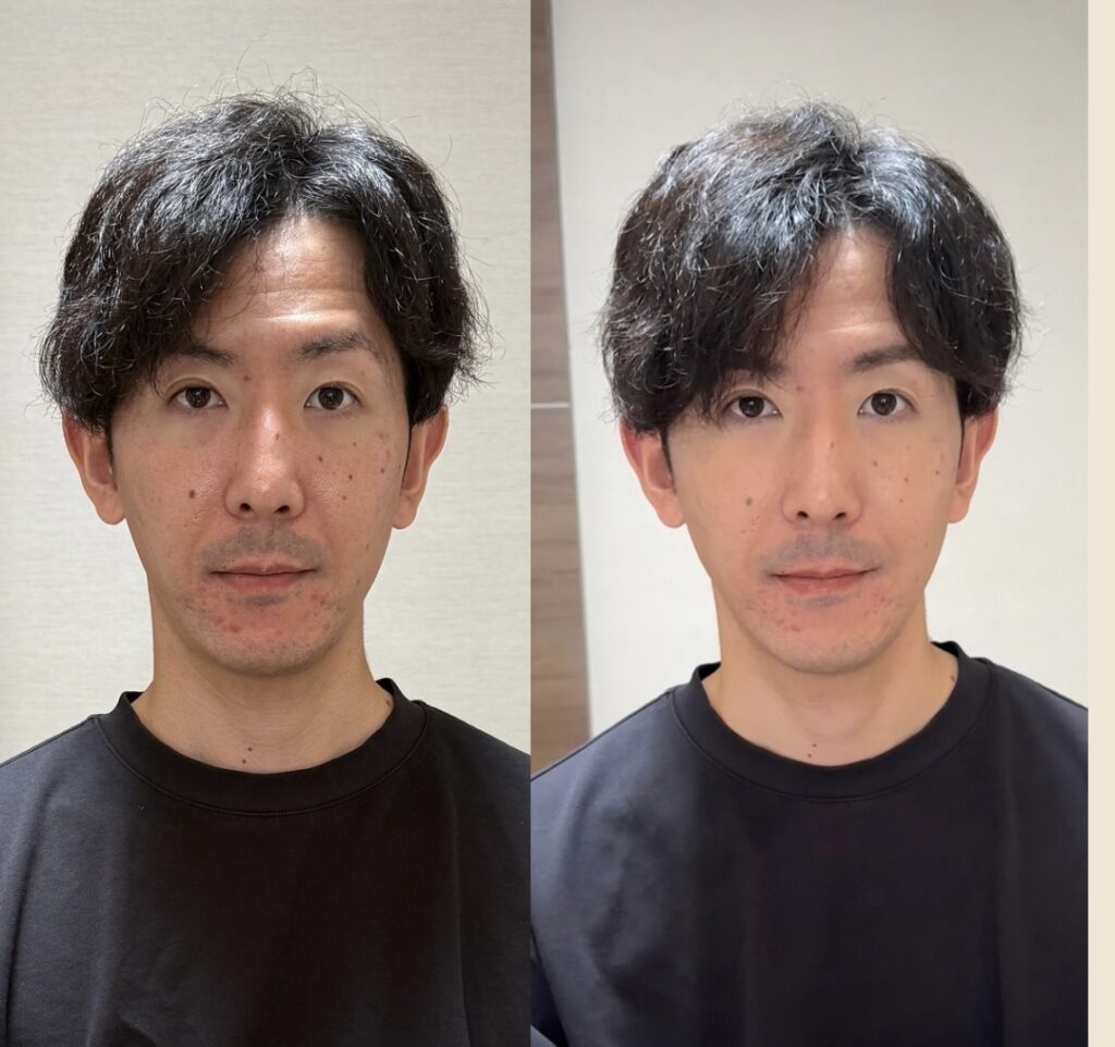 Beige Minimalist Beauty Skincare Before After Collage Instagram Post - 外見は最高の自己紹介。第一印象で“選ばれる”私になる結婚相談所 Se marier 唯 | 群馬・全国オンライン